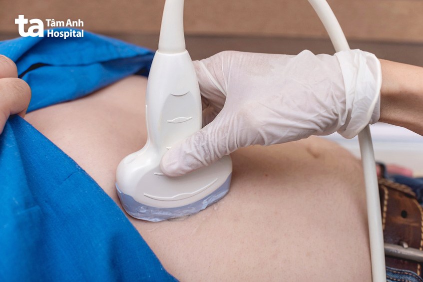 chẩn đoán nang ruột đôi