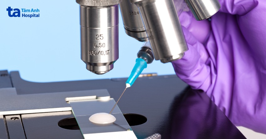 chẩn đoán tinh trùng vón cục