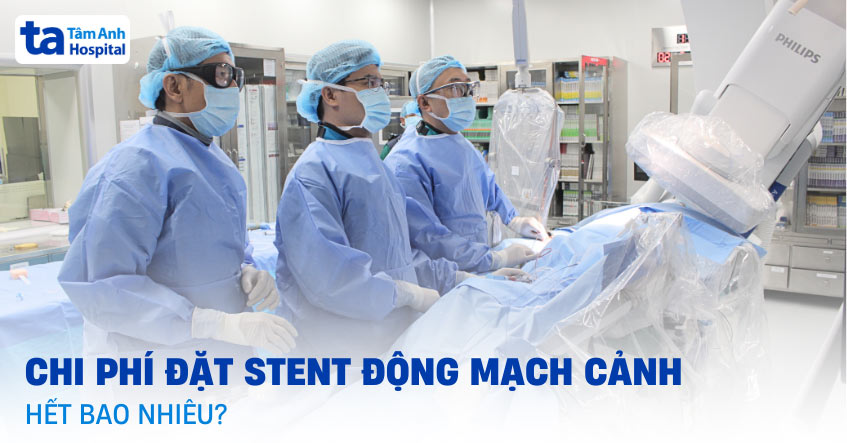 Chi phí đặt stent động mạch cảnh hết bao nhiêu tiền? Bảo hiểm ra sao?