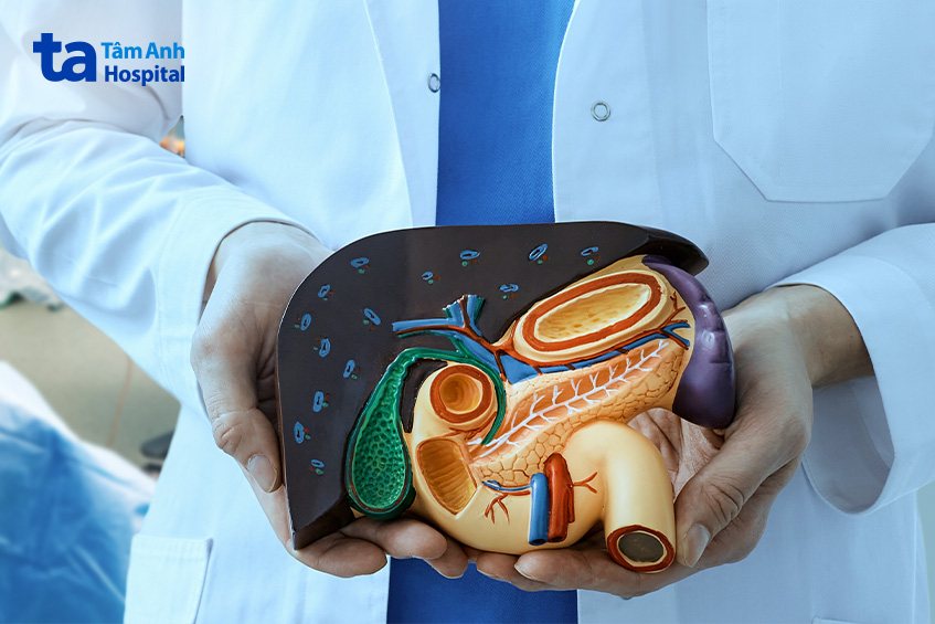 chữa hoại tử tụy