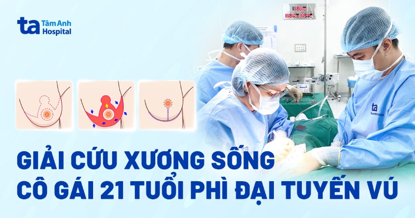 Giải cứu cột sống cho cô gái 21 tuổi phì đại tuyến vú