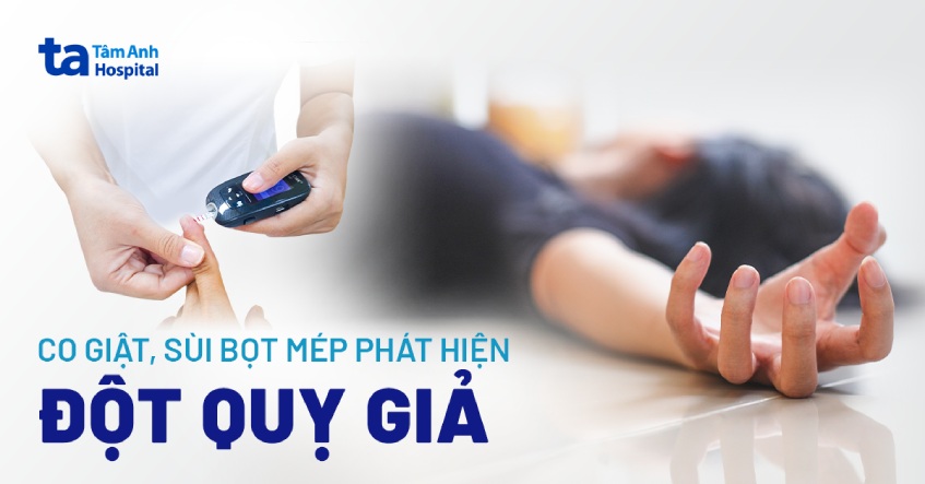 Co giật, sùi bọt mép, phát hiện bệnh đột quỵ giả
