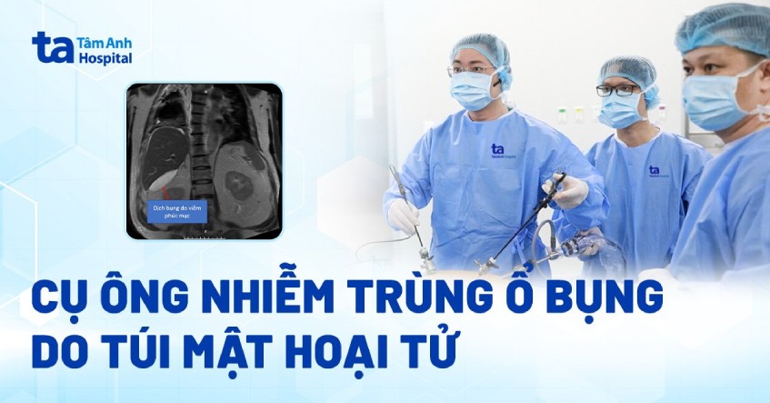 Cụ ông nhiễm trùng ổ bụng do túi mật hoại tử