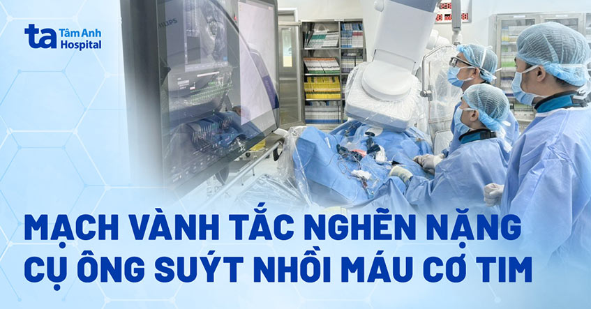Cụ ông suy tim vì mạch vành tắc nghẽn nặng