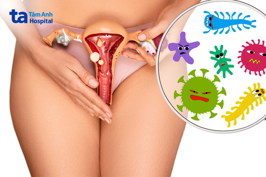 dấu hiệu bất thường ở vùng kín