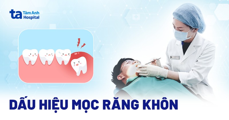 7 dấu hiệu mọc răng khôn phổ biến, dễ nhận biết nhất