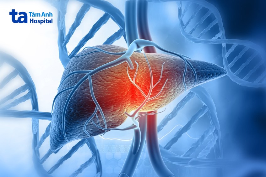 dấu hiệu ung thư vú di căn gan