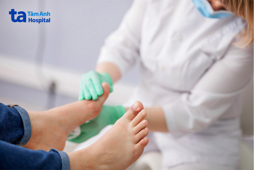 Dị tật bàn chân ưu tiên điều trị bảo tồn