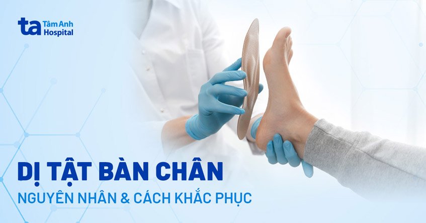 12 dị tật bàn chân thường gặp: Nguyên nhân, dấu hiệu, ảnh hưởng xấu