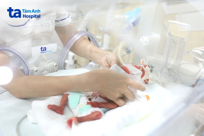 Điều dưỡng chăm sóc bé Bối sinh rất non ở tuần thai 25