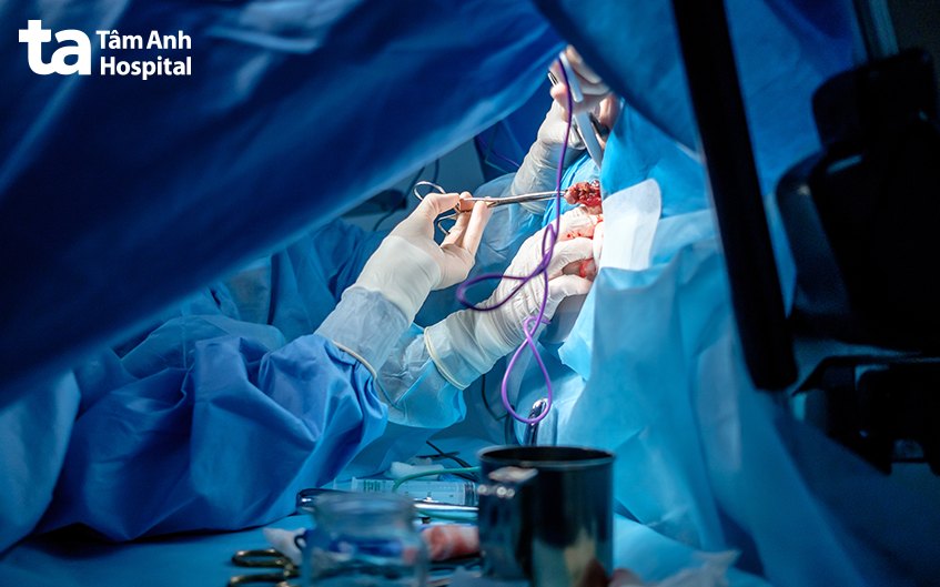 điều trị hẹp hậu môn