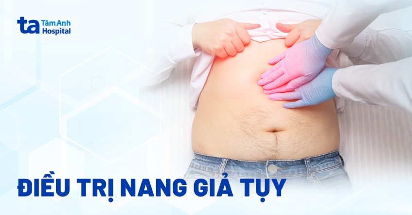 điều trị nang giả tụy
