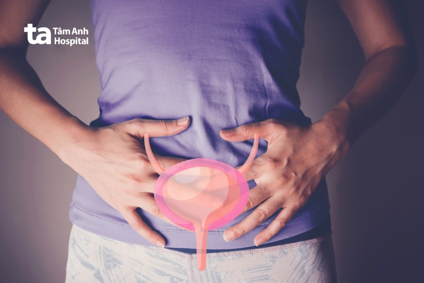điều trị ung thư bàng quang tái phát