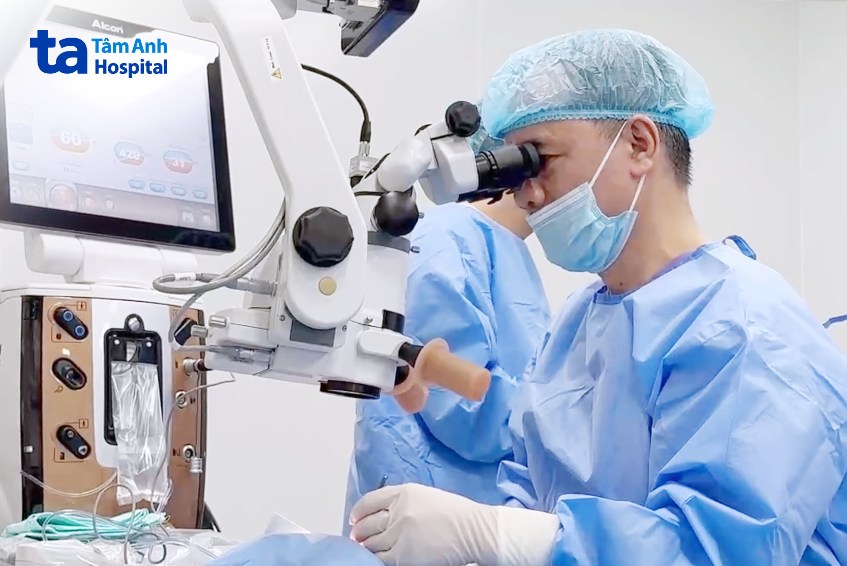 độ bền của thuỷ tinh thể đơn tiêu điểm