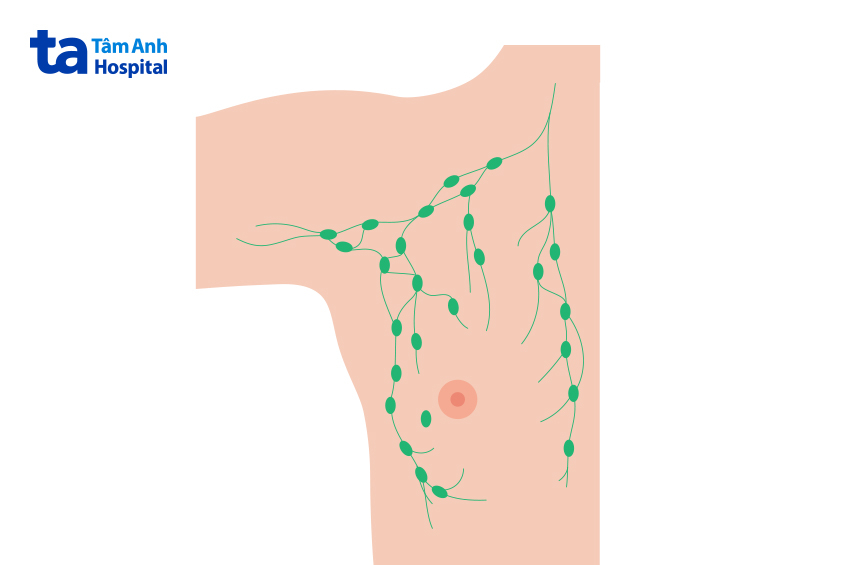 Hạch nách ở trẻ em là gì