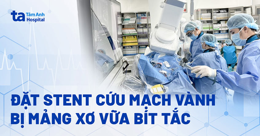 Hẹp mạch vành tưởng do cầu cơ, không ngờ do mảng xơ vữa