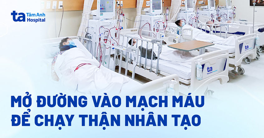 Huyết mạch sinh tồn của bệnh nhân chạy thận nhân tạo