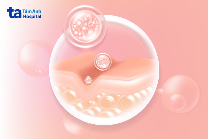 không chạm vào da sau tiêm filler