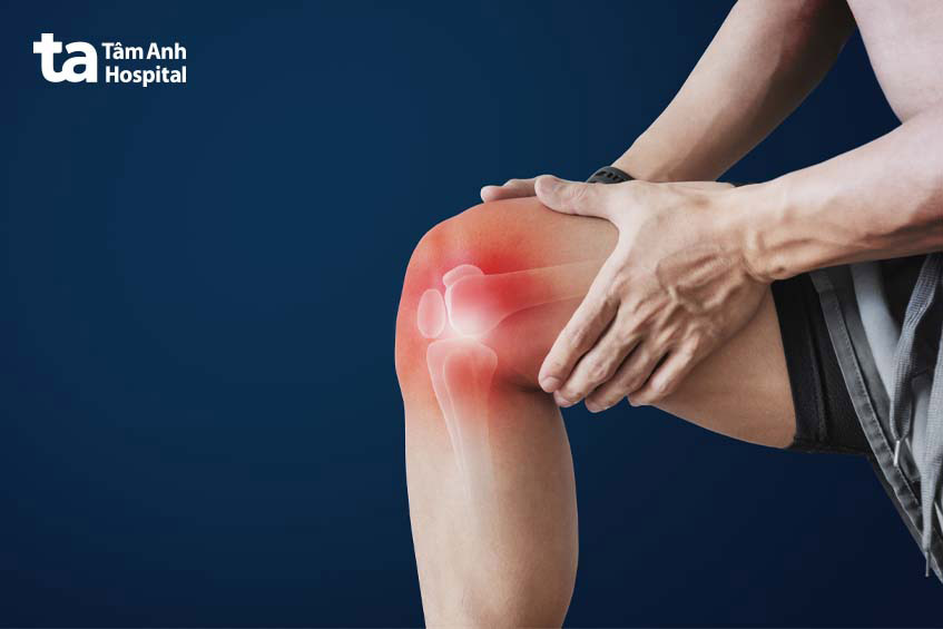 khớp bị tràn dịch gây khó khăn trong sinh hoạt