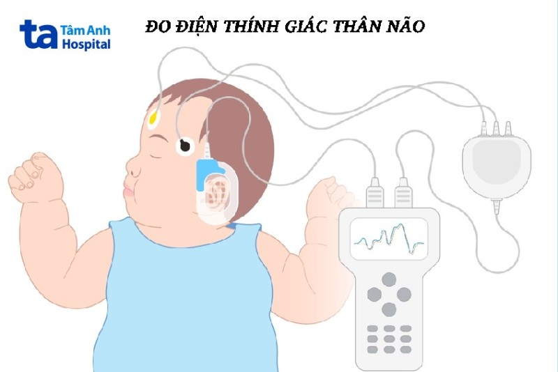 Các nghiệm pháp đo thính lực khách quan