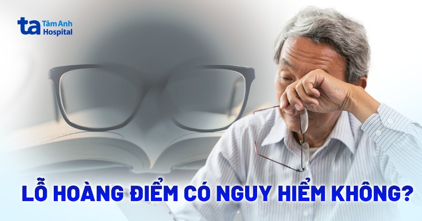 Lỗ hoàng điểm có nguy hiểm không? Cách điều trị để phòng biến chứng