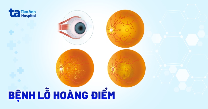 lỗ hoàng điểm