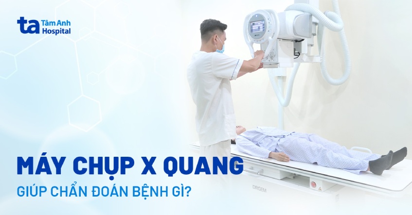 Máy chụp X quang: Cấu tạo, nguyên lý hoạt động và ưu nhược điểm