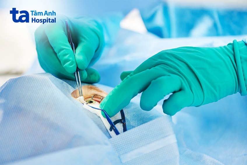 mổ phaco là phương pháp tốt nhất cho người bệnh đục thủy tinh thể