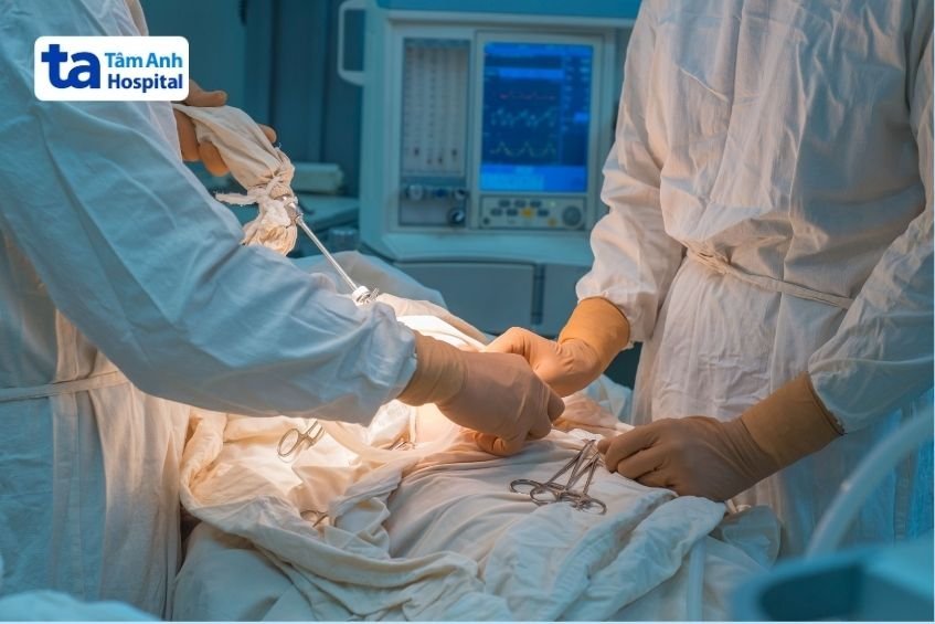 mổ thoát vị thành bụng