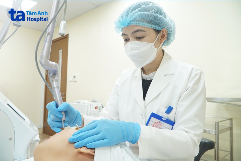 nám chân đinh chữa ở đâu tốt