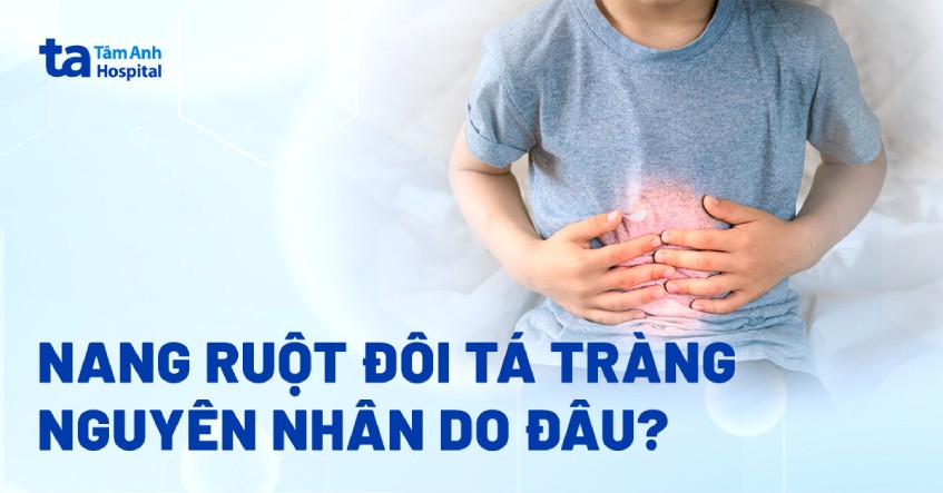 nang ruột đôi tá tràng