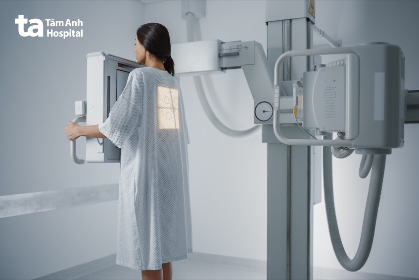 nguyên lý hoạt động của máy chụp x quang