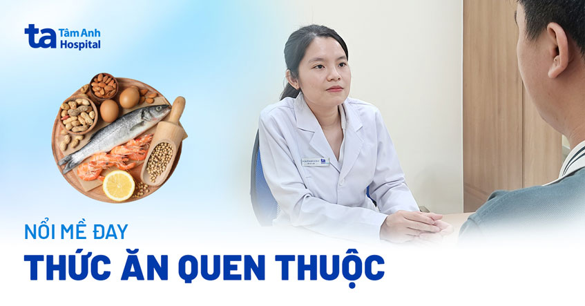 Nổi mề đay do thức ăn quen thuộc