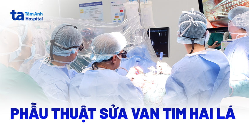 Phẫu thuật sửa van tim hai lá: Quy trình và một số lưu ý