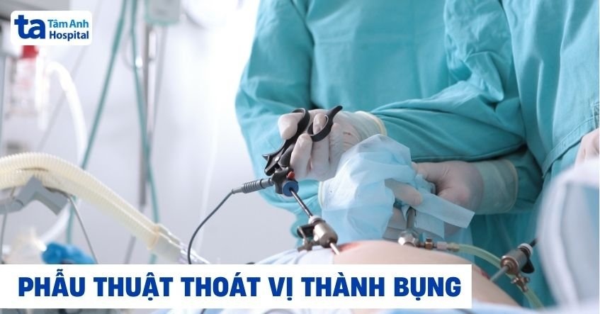 Phẫu thuật thoát vị thành bụng: Quy trình, phương pháp và lưu ý