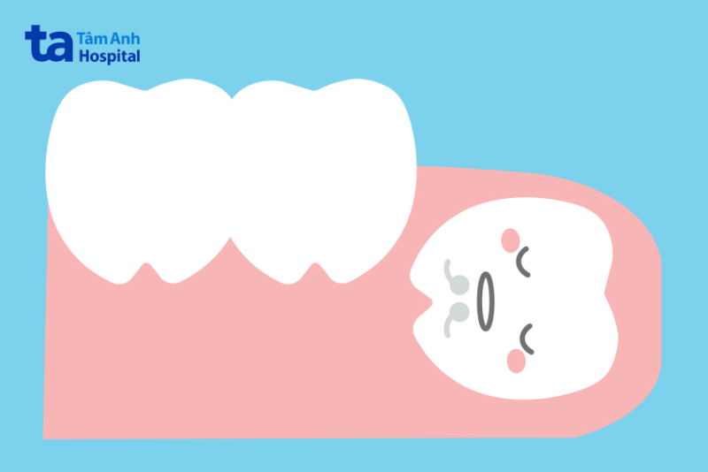 rang-so-8-moc-lech-01