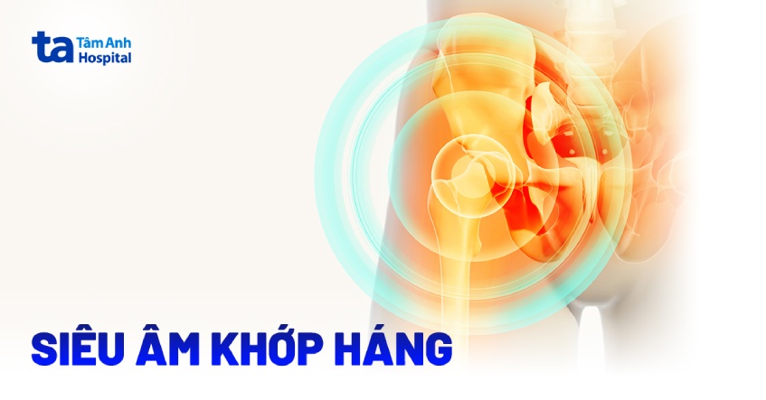 Siêu âm khớp háng giúp phát hiện bệnh gì? Đối tượng và quy trình