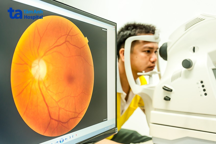 soi đáy mắt trực tiếp giúp bác sĩ có cái nhìn tổng quan về tình trạng bệnh