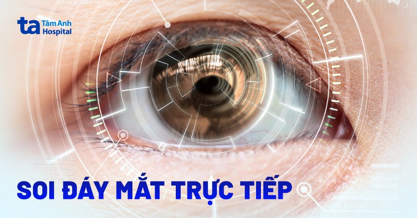 Soi đáy mắt trực tiếp: Chỉ định, quy trình, phương pháp và kết quả