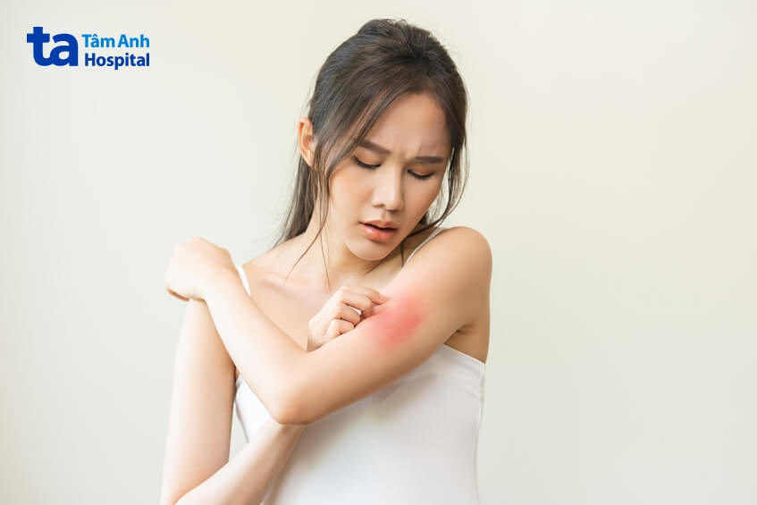 tác dụng phụ của thuốc ngủ gây phát ban ngứa