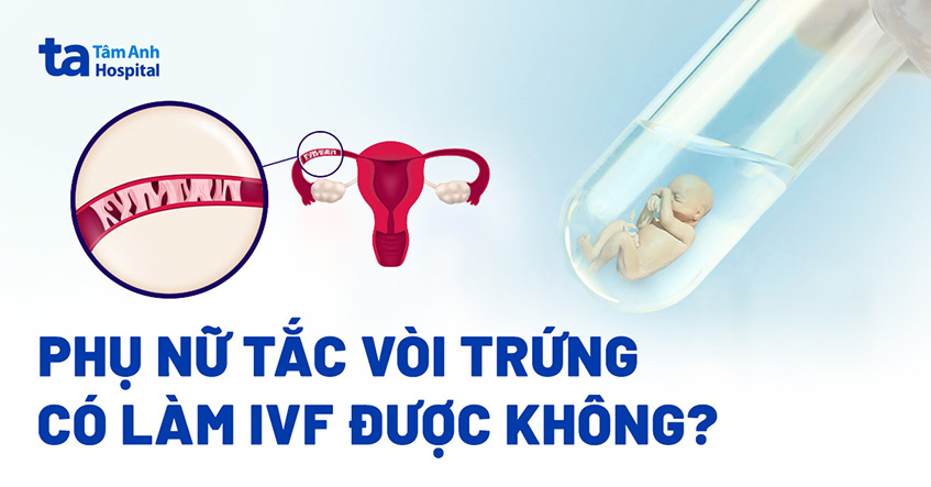 Bị tắc vòi trứng có làm IVF được không? Chuyên gia giải đáp