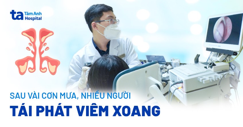 tái phát viêm xoang sau cơn mưa