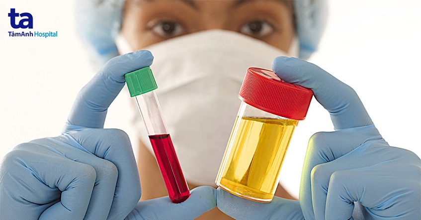 tầm soát chức năng thận hậu covid