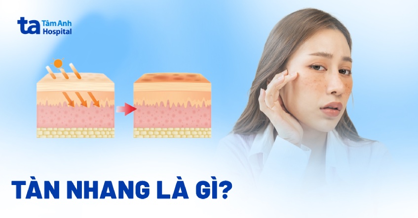 Tàn nhang là gì? 5 nguyên nhân và dấu hiệu nhận biết