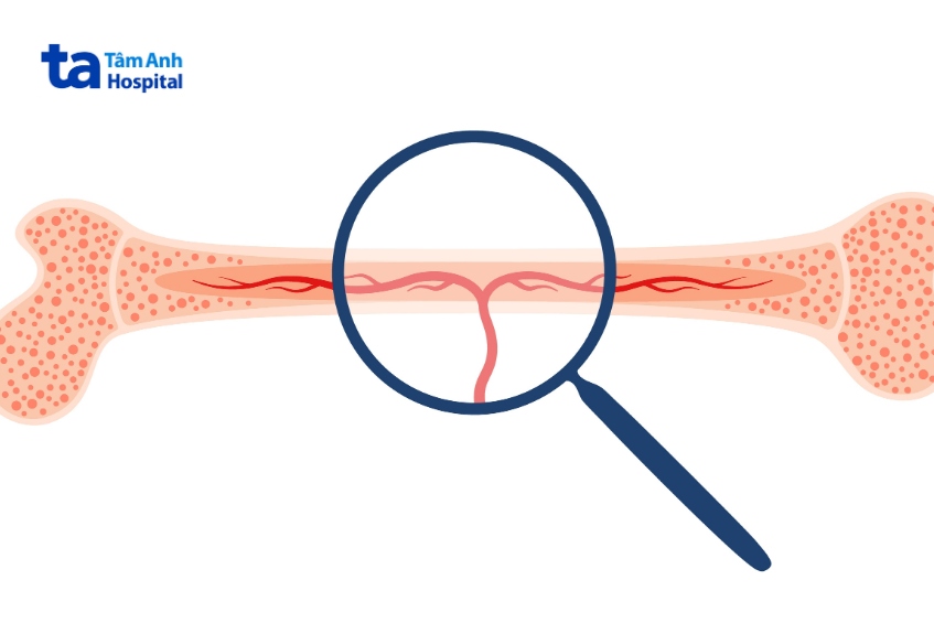 tế bào gốc tủy xương điều trị nhiều bệnh lý