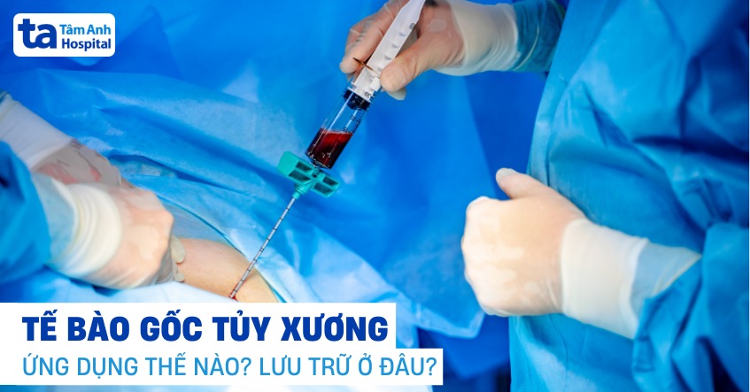 Tế bào gốc tủy xương: Tìm hiểu ứng dụng điều trị nhiều bệnh lý