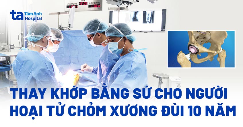 Thay khớp bằng sứ cho người hoại tử chỏm xương đùi 10 năm