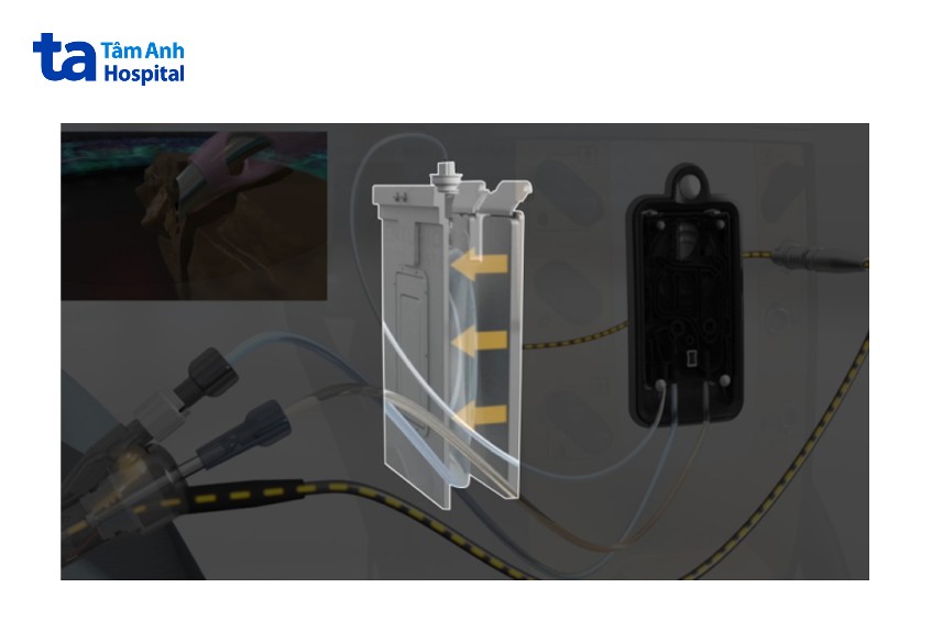 thế hệ máy tích hợp công nghệ active fluidics