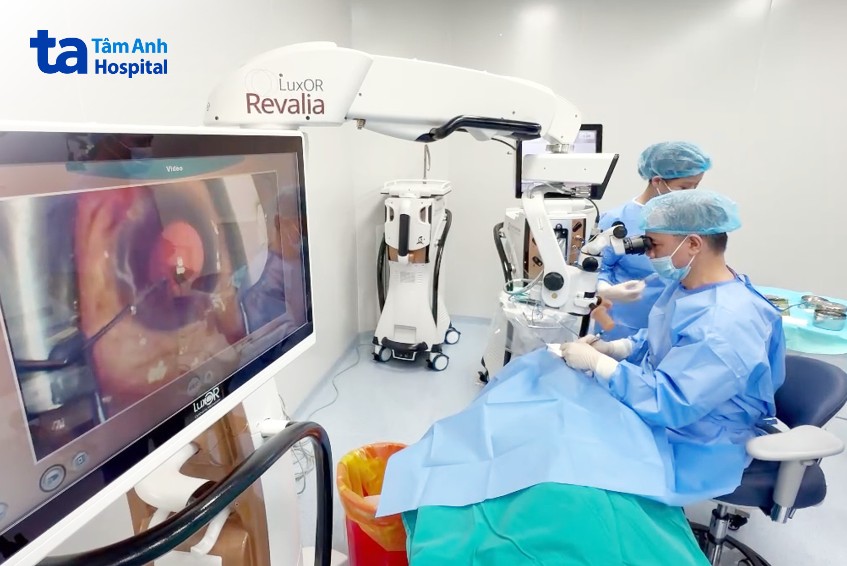 thuỷ tinh thể đa tiêu cự