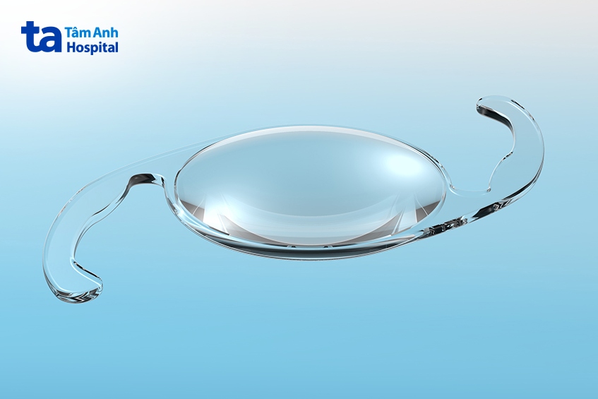 thuỷ tinh thể đa tiêu điểm loại nào tốt nhất